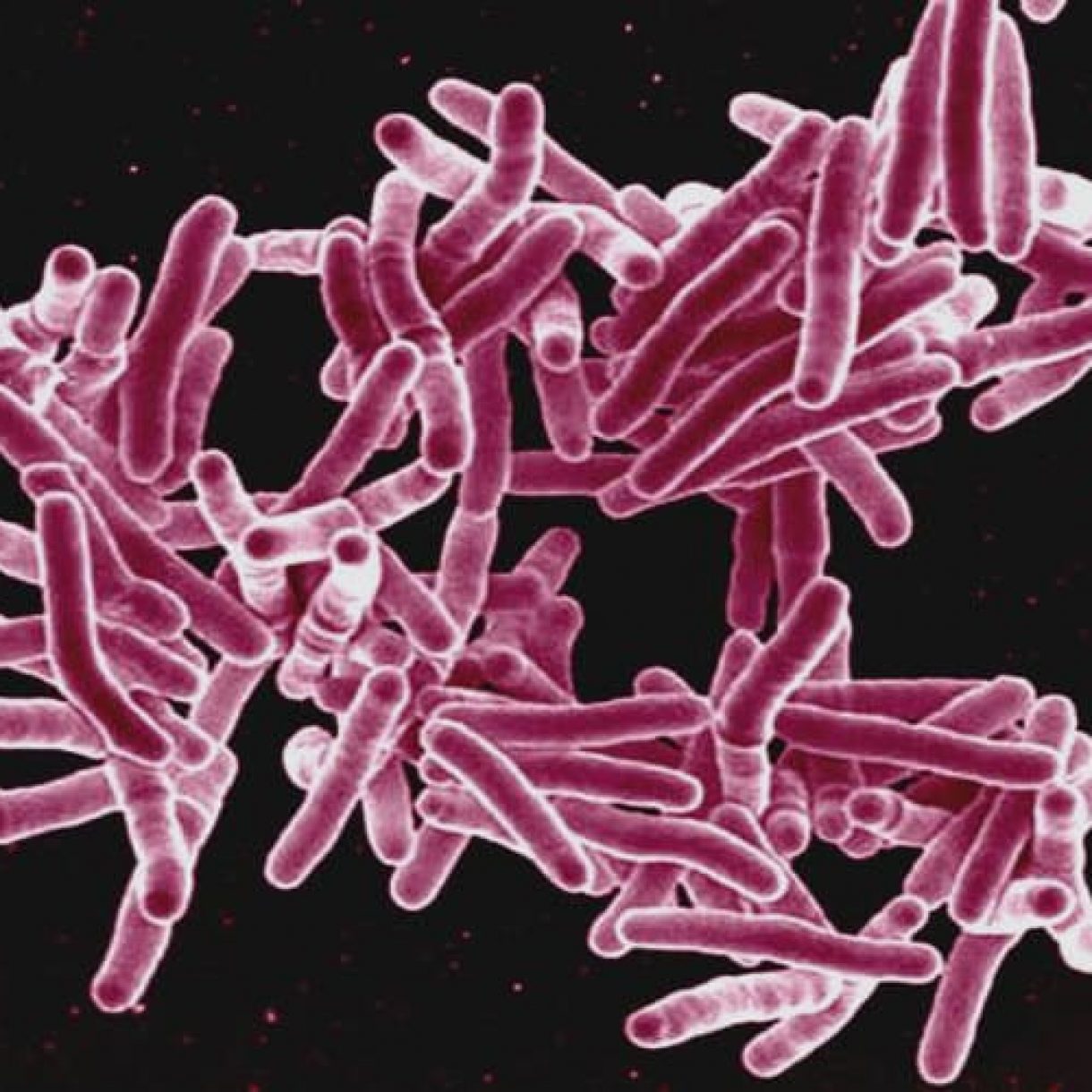1416138523 mycobacterium tuberculosis jpg