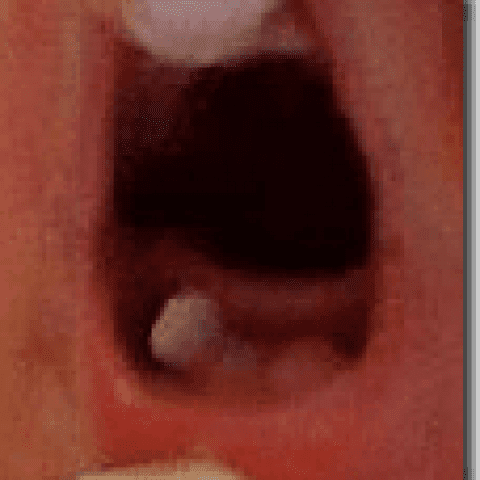 Image thumb png