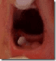 Image thumb png