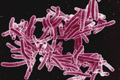 1416138523 mycobacterium tuberculosis jpg