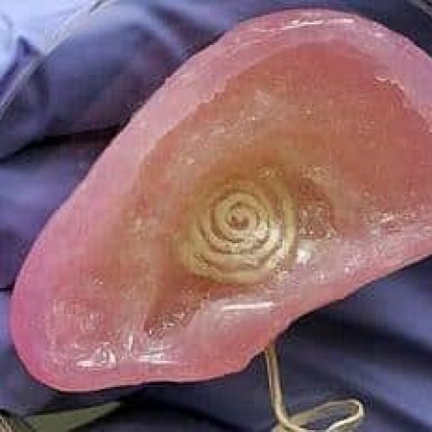 Una Oreja Bionica Podria Mejorar El Oido Humano